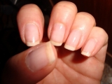 Orice schimbare de culoare a unghiilor poate fi semnul unei probleme de sănătate