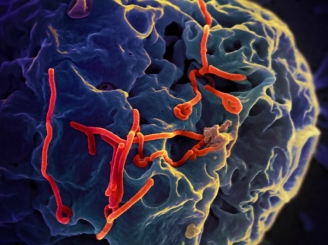 ebola-sufera-mutatii-virusul-poate-deveni-mai-periculos-ca-niciodata-45409-1.jpg