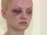 Imagini terifiante! Alexandra Stan, bătută cu bestialitate de propriul manager